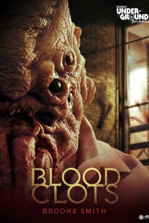 Blood Clots