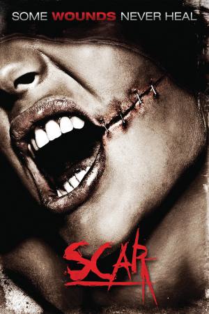 Scar
