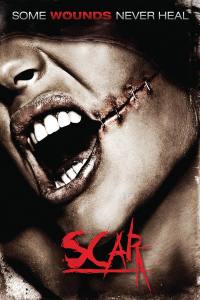Scar