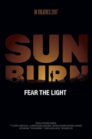 Sunburn